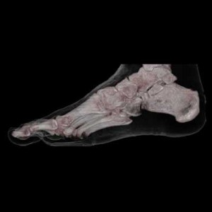 CT_3D_human_Foot_Skin_and_Bone